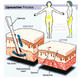 Umesh Bansal Physiotherapy dayaa bansal 25