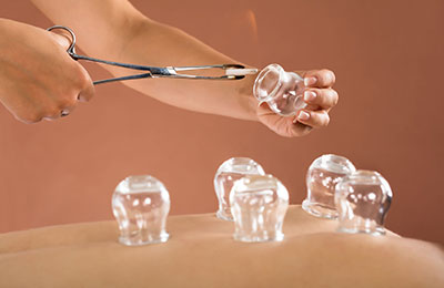 Umesh Bansal Physiotherapy cupping